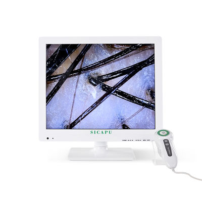 17 Inch Screen Hair Analyzer Machine 2.0 Megapixels Hair And Scalp Test Machine
